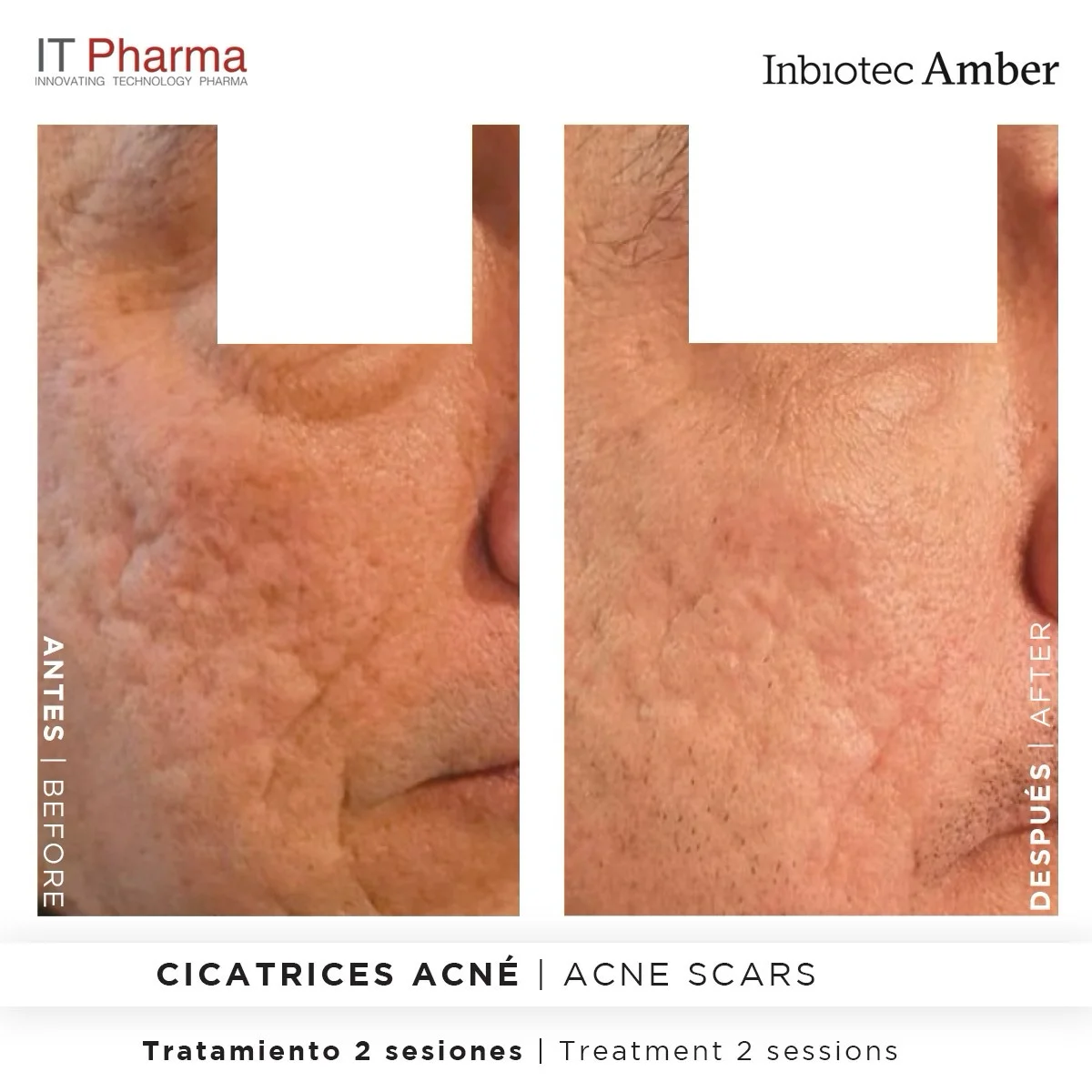 Inbiotec Amber