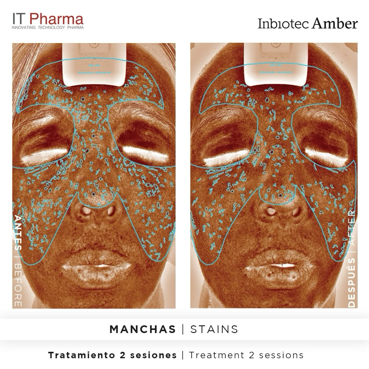 Inbiotec Amber