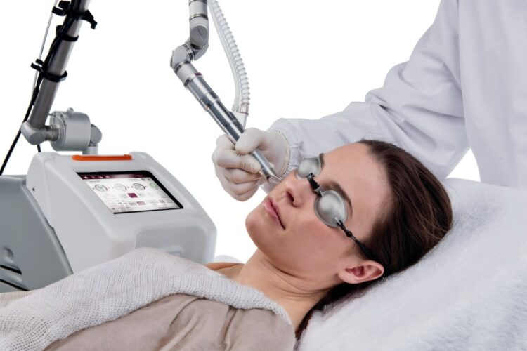 CoolPeel Deka- gentle CO2 Laser