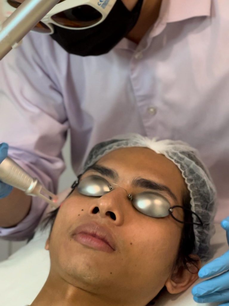 Dr. Victor is performing Picoplus Lutronic laser on patient. 
